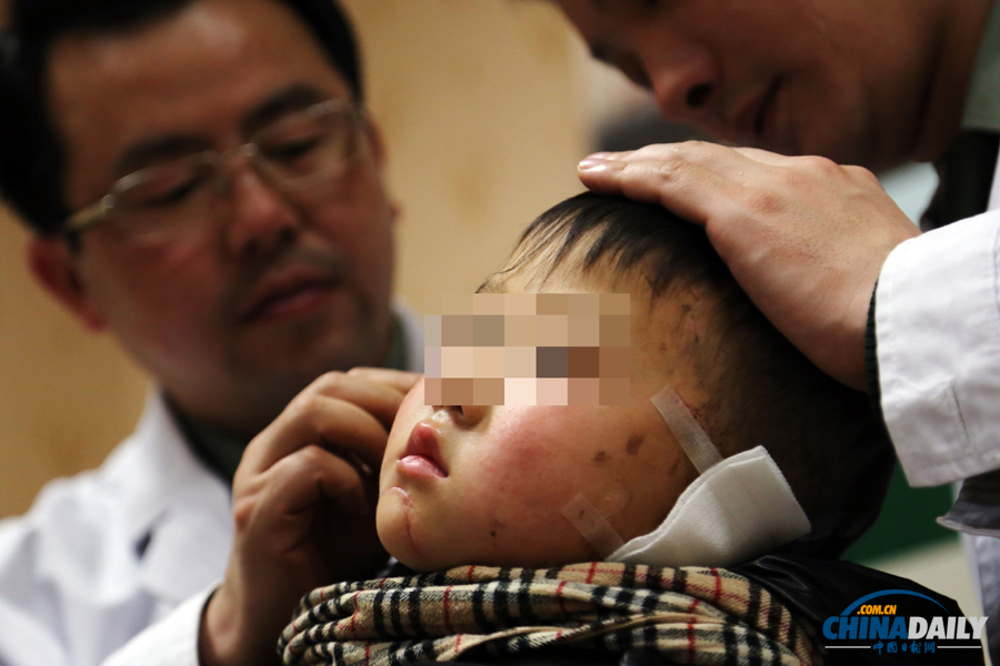 6歲男童慘遭嬸嬸割耳續：有醫院免費為他造左耳