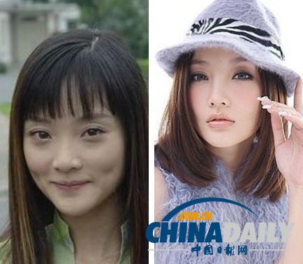 柳巖李小璐楊冪 女星整容前驚人對比照