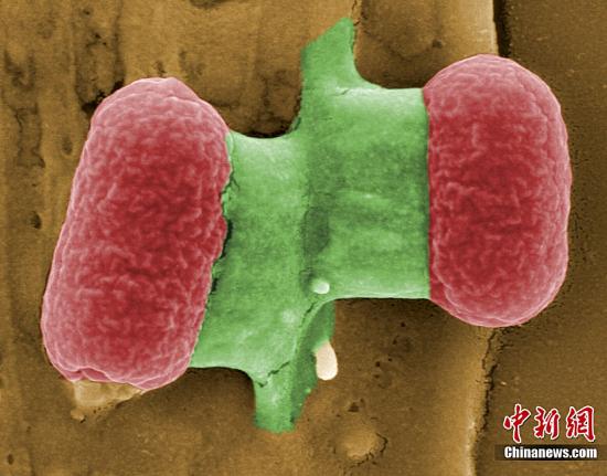 歐洲大腸桿菌源頭再度成謎 沼氣廠疑是病菌溫床