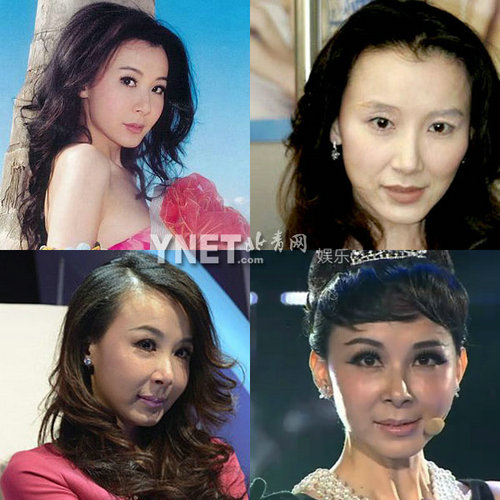 明星整容慘面癱 大S李小璐越發詭異