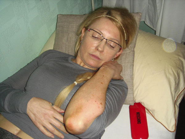 Tymoshenko claims she was beaten in jail